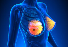 breast cancer, types of breast cancer, organs of breast, what are the internal parts of breast, how does breast cancer spread, spread of breast cancer
