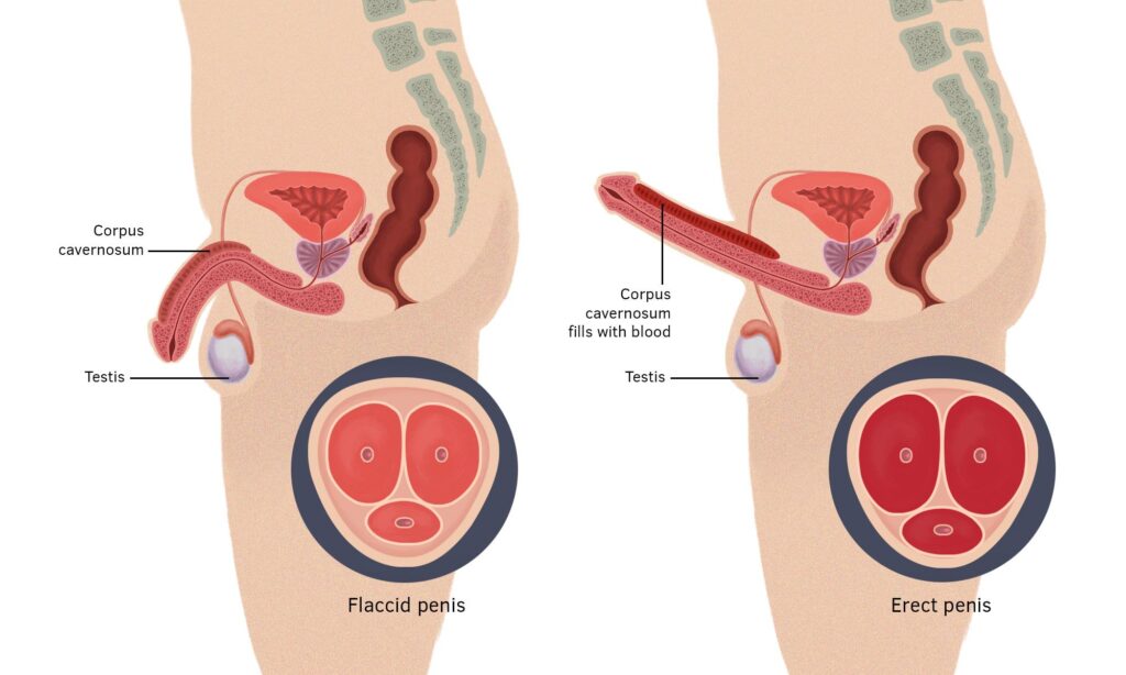 penis, penis dysfunction, penis cannot stand, penis can't get hard, penis cannot stand hard